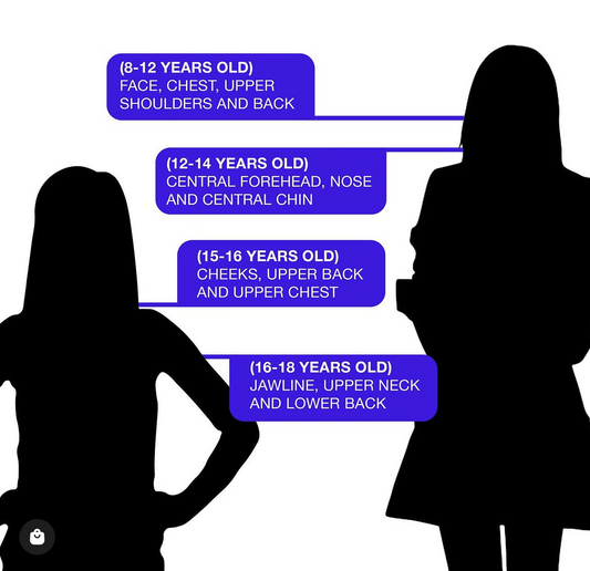 Stages of oil production and their impact on acne for tweens