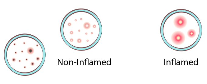 Non-Inflamed Acne Routine